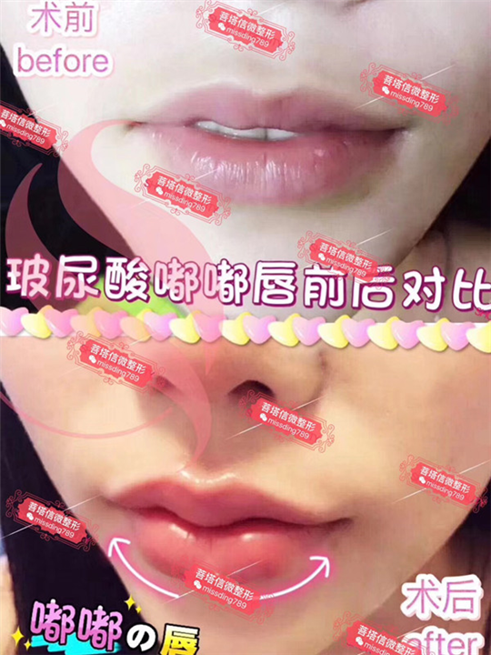 重庆微整形|重庆做微整形哪家好