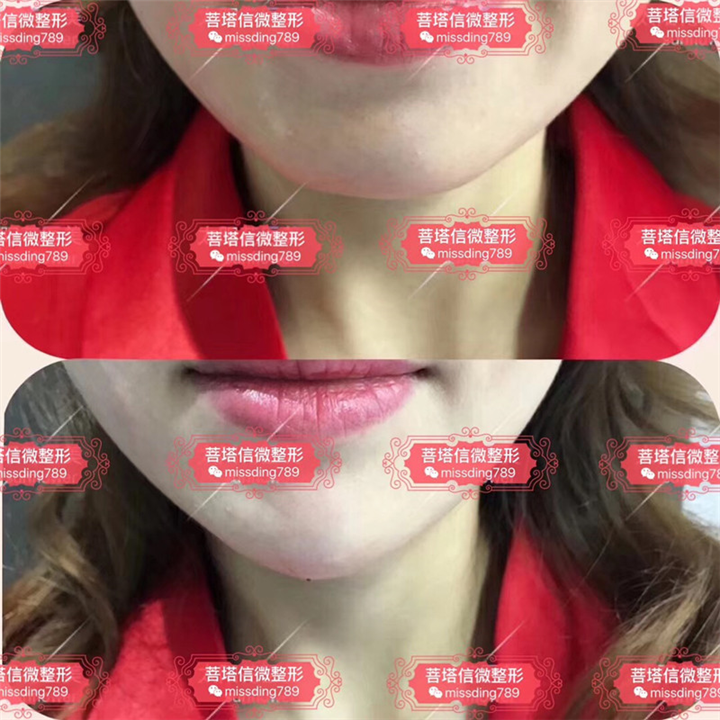 重庆做微整形哪家好|重庆人气网红整形