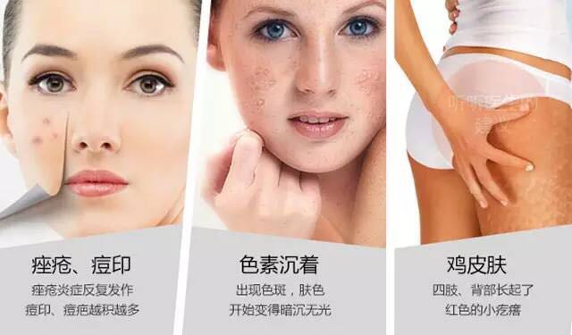 重庆皮肤管理好吗？
