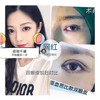 重庆做鼻综合哪家好|重庆眼综合整形
