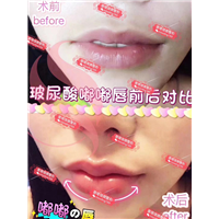 重庆微整形|重庆做微整形哪家好