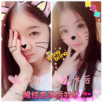 重庆注射玻尿酸|重庆玻尿酸注射隆鼻