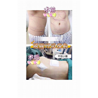 广东鼻综合整形|广东眼综合整形