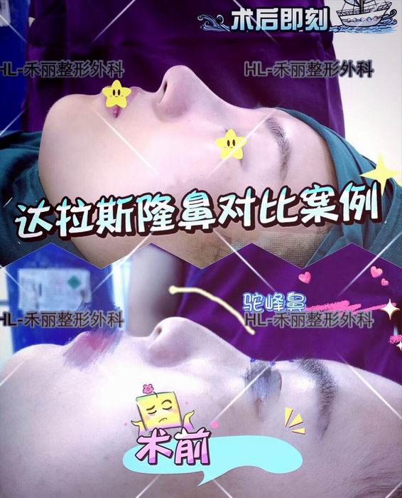 广东网红整形|广东网红整形医院