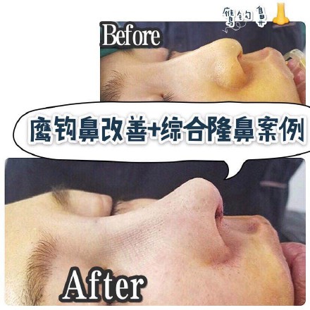 广东网红整形|广东网红整形医院