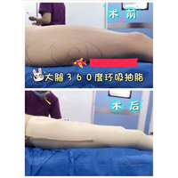 广东鼻综合整形|广东眼综合整形