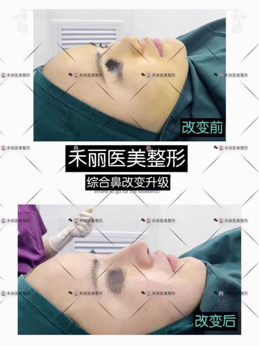 广东网红整形|广东网红整形医院
