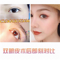 广东网红整形|广东网红整形医院