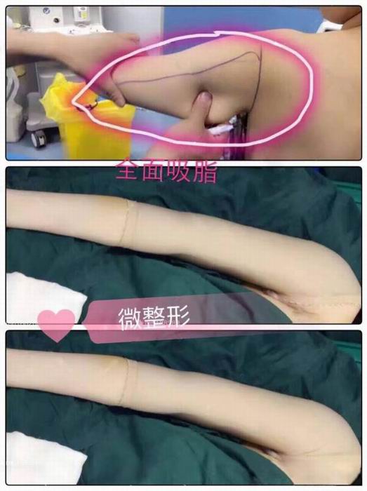 广东鼻综合整形|广东眼综合整形