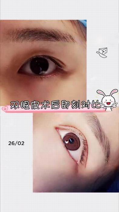 广东网红整形医院|广东鼻综合整形