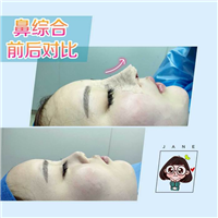 广东网红整形医院|广东鼻综合整形