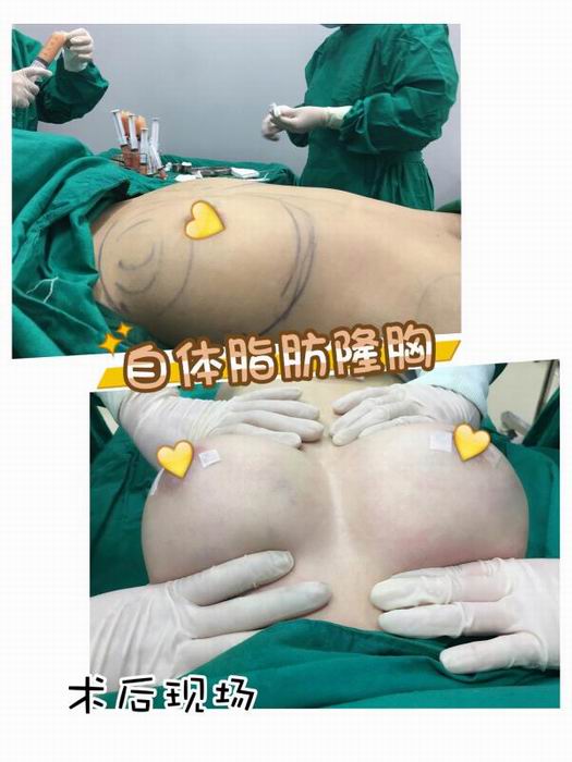 广东人气网红整形|广东专业网红整形