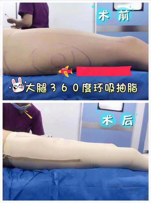 广东鼻综合整形|广东眼综合整形