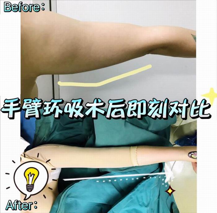 广东鼻综合整形|广东眼综合整形