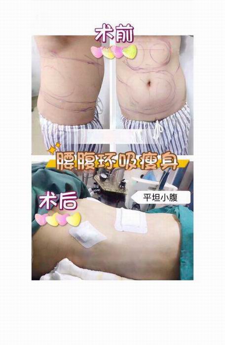 广东鼻综合整形|广东眼综合整形