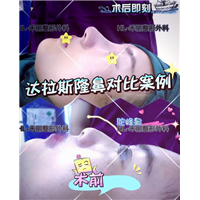 广东网红整形|广东网红整形医院