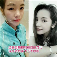 广东网红整形|广东网红整形医院