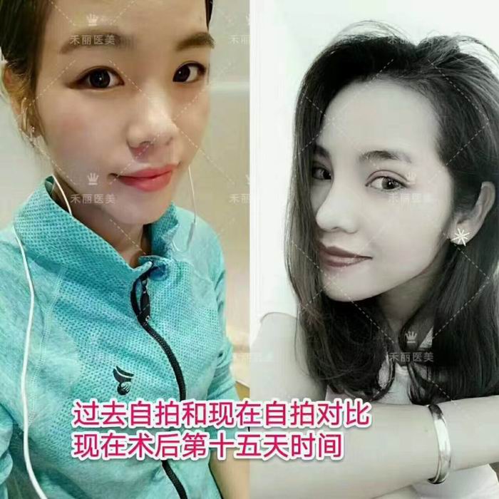 广东网红整形|广东网红整形医院