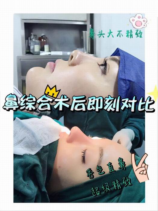 广东网红整形医院|广东鼻综合整形