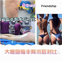 广东眼综合整形|广东人气网红整形