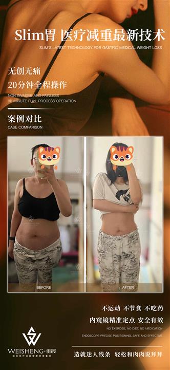 胃镜注射减重