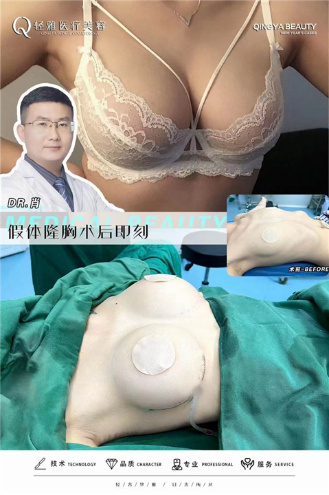 广州轻雅整形