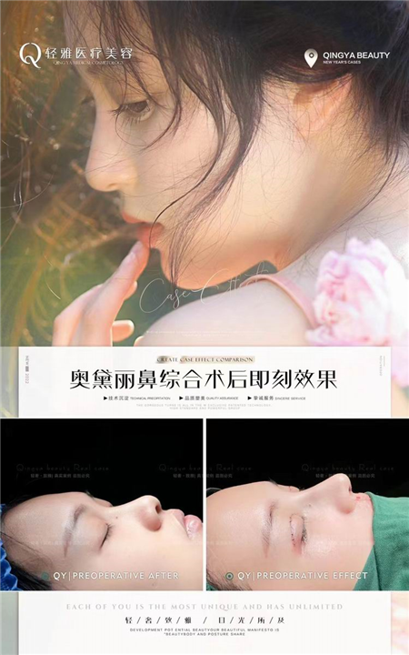 轻医美品牌加盟