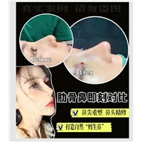 上海鼻综合整形修复美丽之星