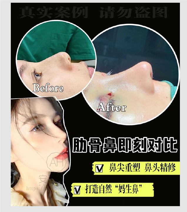 上海鼻综合整形修复美丽之星