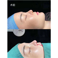 广州网红整形医院｜婕熹卡整形靠谱吗