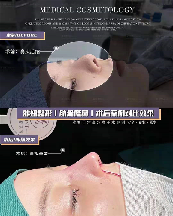 广州网红整形｜广州网红整形医院