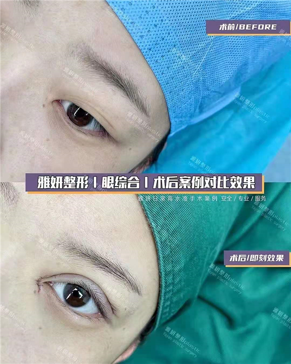 广州网红整形｜广州网红整形医院