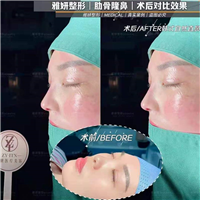 广州雅妍医疗整形 