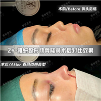 广州雅妍医疗整形 