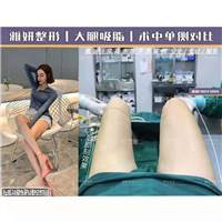 婕熹卡整形｜广州网红整形