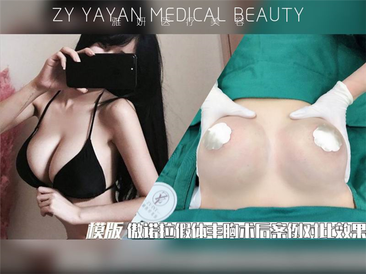广州雅妍整形医院 