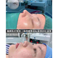 广州雅妍医疗整形 