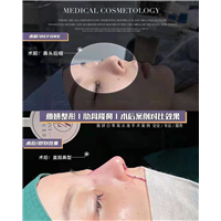 广州网红整形｜广州网红整形医院