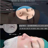 广州雅妍医疗整形 