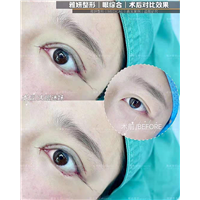广州网红整形医院｜婕熹卡整形靠谱吗