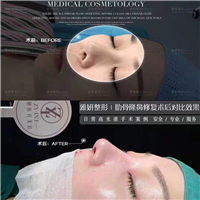 婕熹卡整形｜广州网红整形