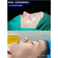 任静医生怎么样