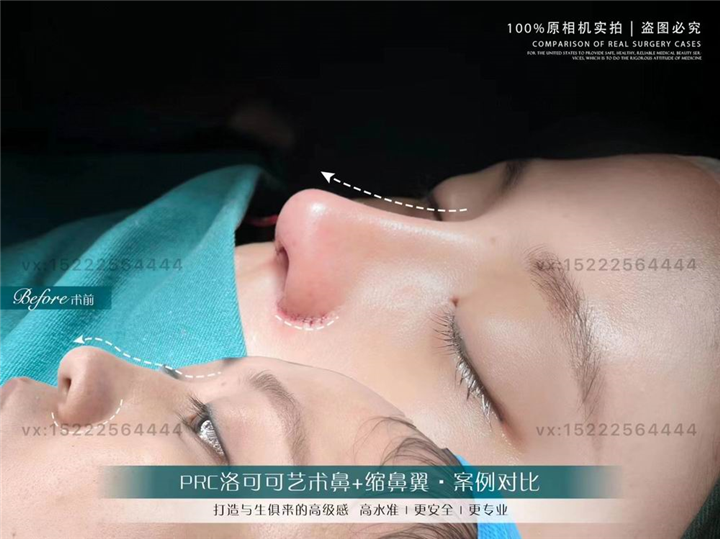 任静医生怎么样