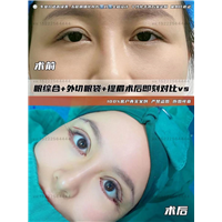 任静整形医生