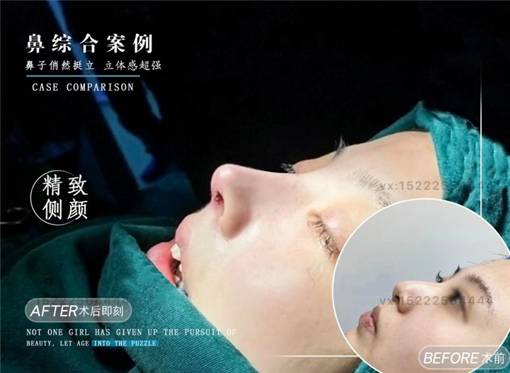 天津任静整形医生