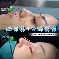 任静医生怎么样