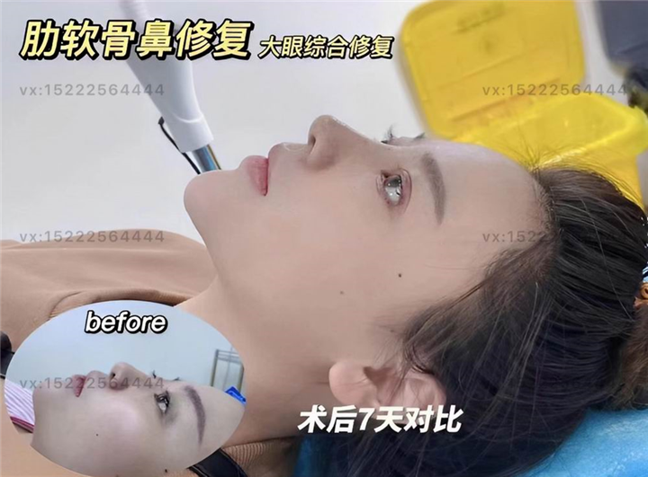 任静医生怎么样