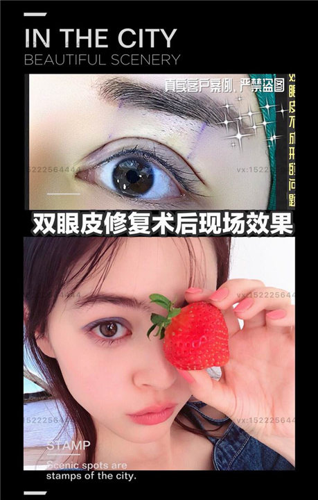 天津面部年轻化医生