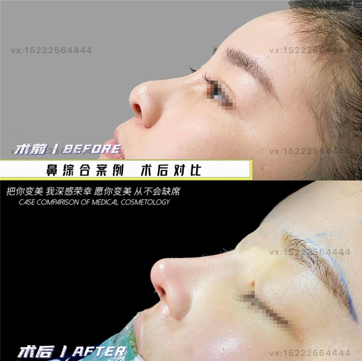 任静整形