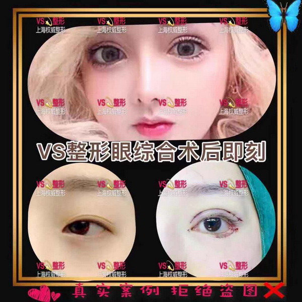 上海VS国际|上海VS整形